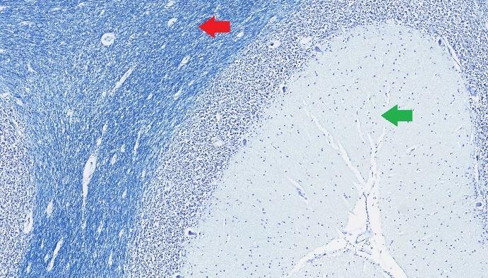 Färgningsprotokoll 1a Vävnaden som färgades in enligt färgningsprotokoll 1a och markerade med 1, hade en godkänd infärgning av cerebellum (figur 1) och infärgningen av IK i hjärtvävnaden från hjärta