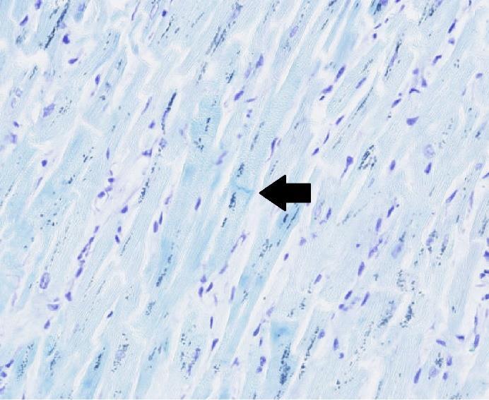 Färgningsprotokoll 2a Vävnaden som färgades in enligt färgningsprotokoll 2a och markerad med 2 hade en godkänd infärgning av cerebellum och infärgningen av hjärtvävnaden från