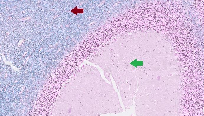 Figur 8. Röda pilen indikerar vit substans, färgad blå på grund av myelin runt axonen. Den gröna pilen indikera den grå substansen. 100 x förstorning Figur 9.