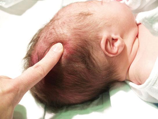 till sjuksköterska Bernt Alm barnhälsovårdsöverläkare Bakgrund Tillväxt