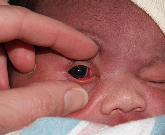 the occiput and the opposite frontal region and face (Fig.