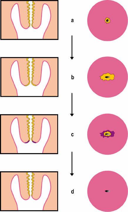 2. PROVTAGNING AV CELLPROV FÖR CYTOLOGI OCH HPV (Kapitel 11 i vårdprogrammet) För att uppnå god provkvalitet krävs att proven är tagna från rätt ställe, transformationszonen, det område där i stort