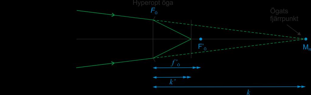 Optik 1 53 Figur 10.8 Hyperopt öga, objekt i fjärrpunkten För en hyperop person ligger fjärrpunkten bakom ögat.