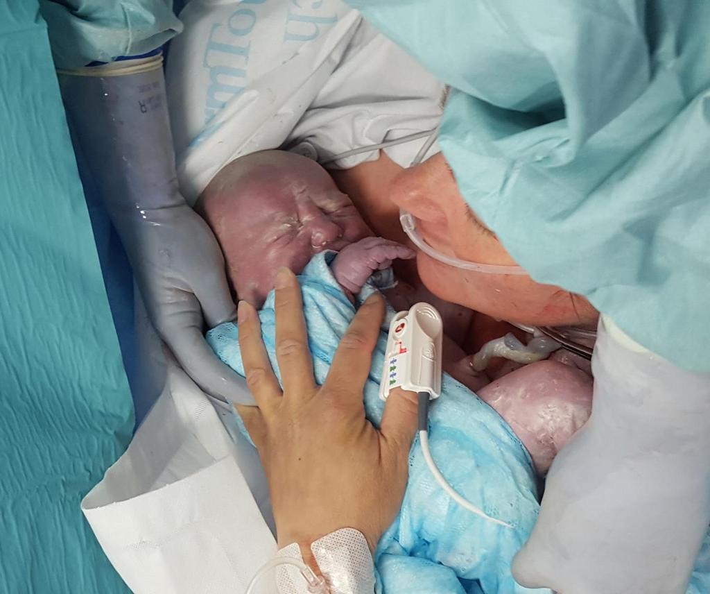 När barnet är fött väntar vi med att klippa navelsträngen så att barnet får i sig extra navelsträngsblod. Om barnet är friskt och fullgånget kan det komma direkt hud mot hud med dig!