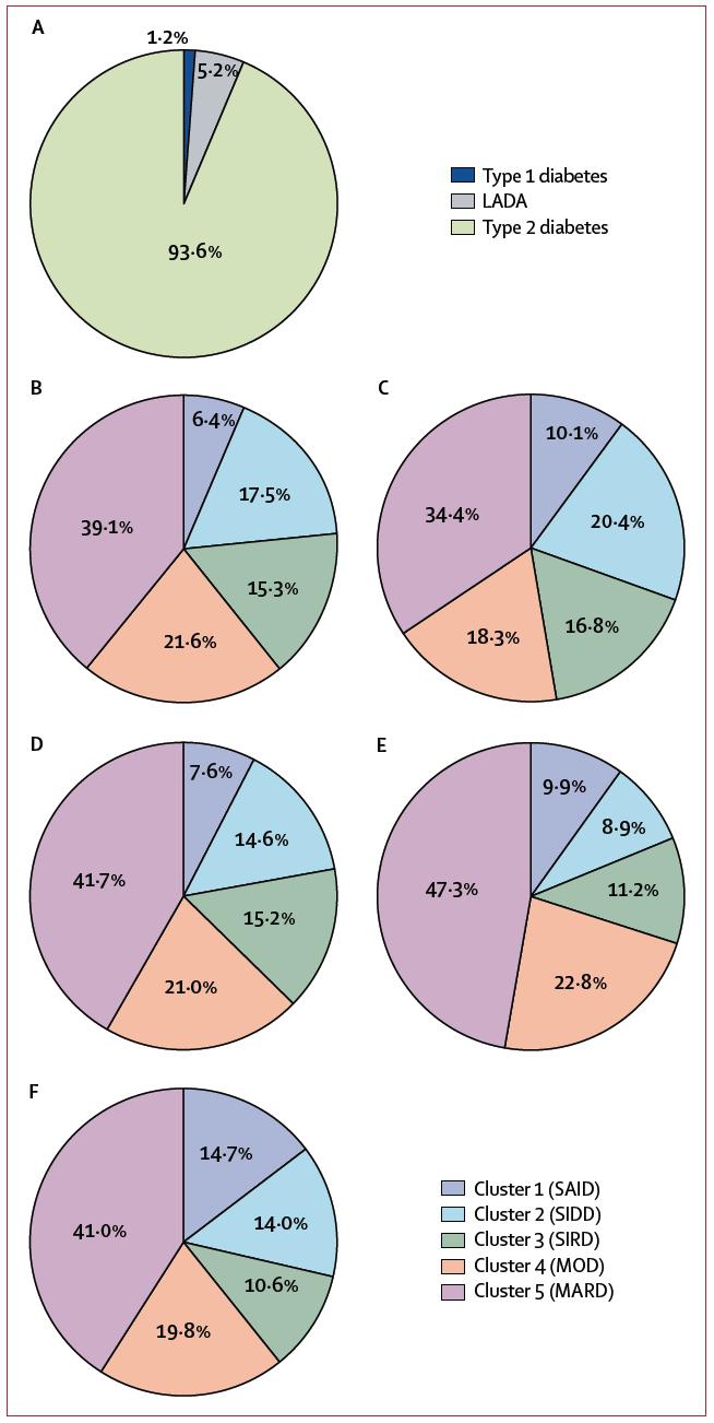 Distribution före och efter klusterindelning i samtliga kohorter A. ANDIS (Alla nya Diabetiker i Skåne) n=8980 B. ANDIS efter klusterindelning C. Skåne Diabetesregistret (SDR) n=1466 D.