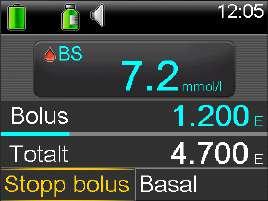 Observera: Här beskrivs hur man stoppar en pågående bolus. Detta stoppar inte din dosering av basalinsulin.