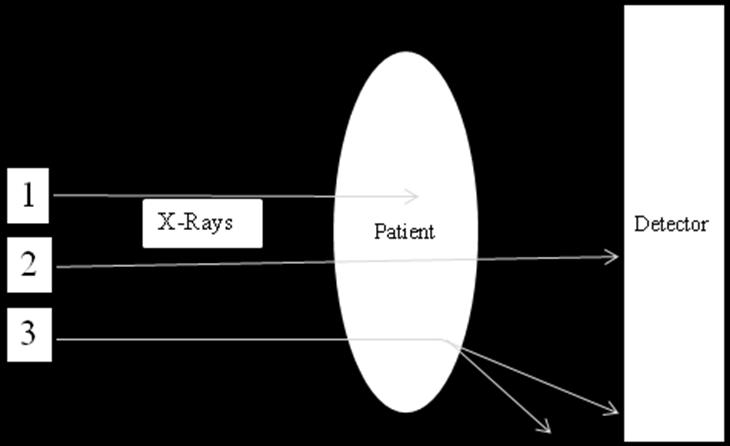 2.2 The X- ray interaction with the patient The X- ray photons on their way through the patient undergo an interaction or an attenuation process before they are captured by an image receptor.