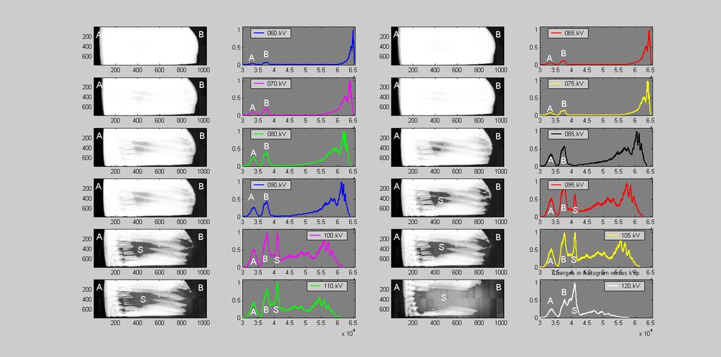 5 RESULT AND DISCUSSION Study case 1: Nominal 100 mas in open field and varying peak potential (kvp). Figure 11: Histogram changes for different nominal kvp.