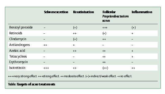 Kom ihåg: adapalen (=retinoid) + bensoylperoxid (Epiduo gel) är 1:a linjens topikala medel.