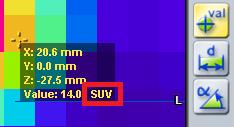iplan RT Image (under v.4.1.2) / iplan RT; samt BrainSCAN (upphört). Markus Hofmann, Senior MDR och säkerhetschef. CAPA-20150727-001458 Råd rörande användning av enheten, modifikation av enheten.