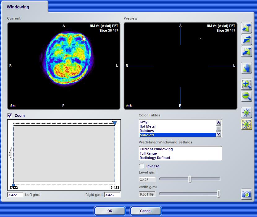 Bilaga Verifiering av bilduppsättningar som laddats in i Brainlabs programvara för planering av strålbehandling 1.