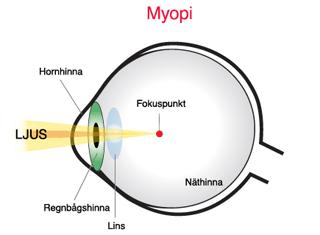Pupillens storlek ändras automatiskt av ögat, vilket gör att det kommer in lagom mycket ljus. 1. Ljuset åker genom den konvexa linsen som samlar ihop ljusstrålarna.