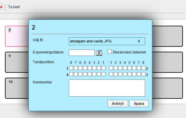 33 (35) I rutan som öppnas ska man ange exponeringsdatum.