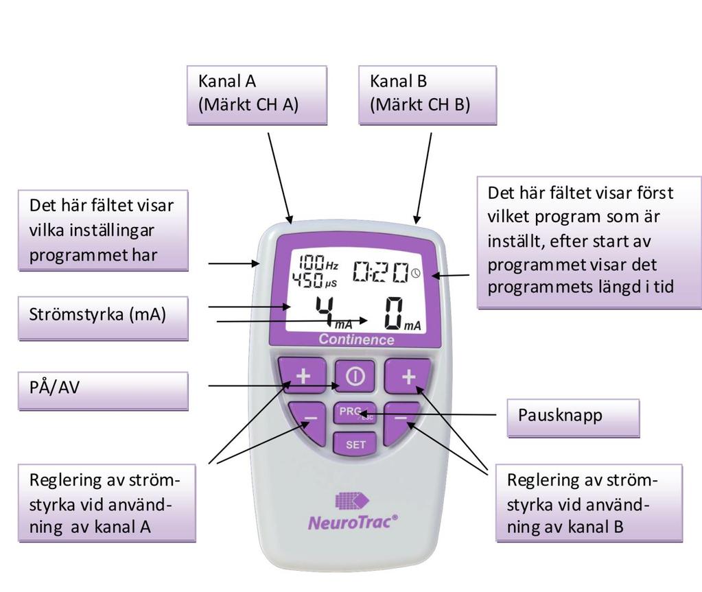 Det här är NeuroTrac Continence Nyare versioner av NeuroTrac continence har en uppdaterad skärbild då stimuleringen är påbörjad. Observera även omplaceringen av symbolerna.