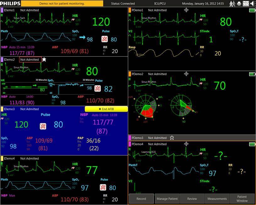 Connected Care Solutions -4/5- FSN86201639, FSN86201640 BRÅDSKANDE SÅ HÄR IDENTIFIERAS BERÖRDA PRODUKTER PIIC ix-version