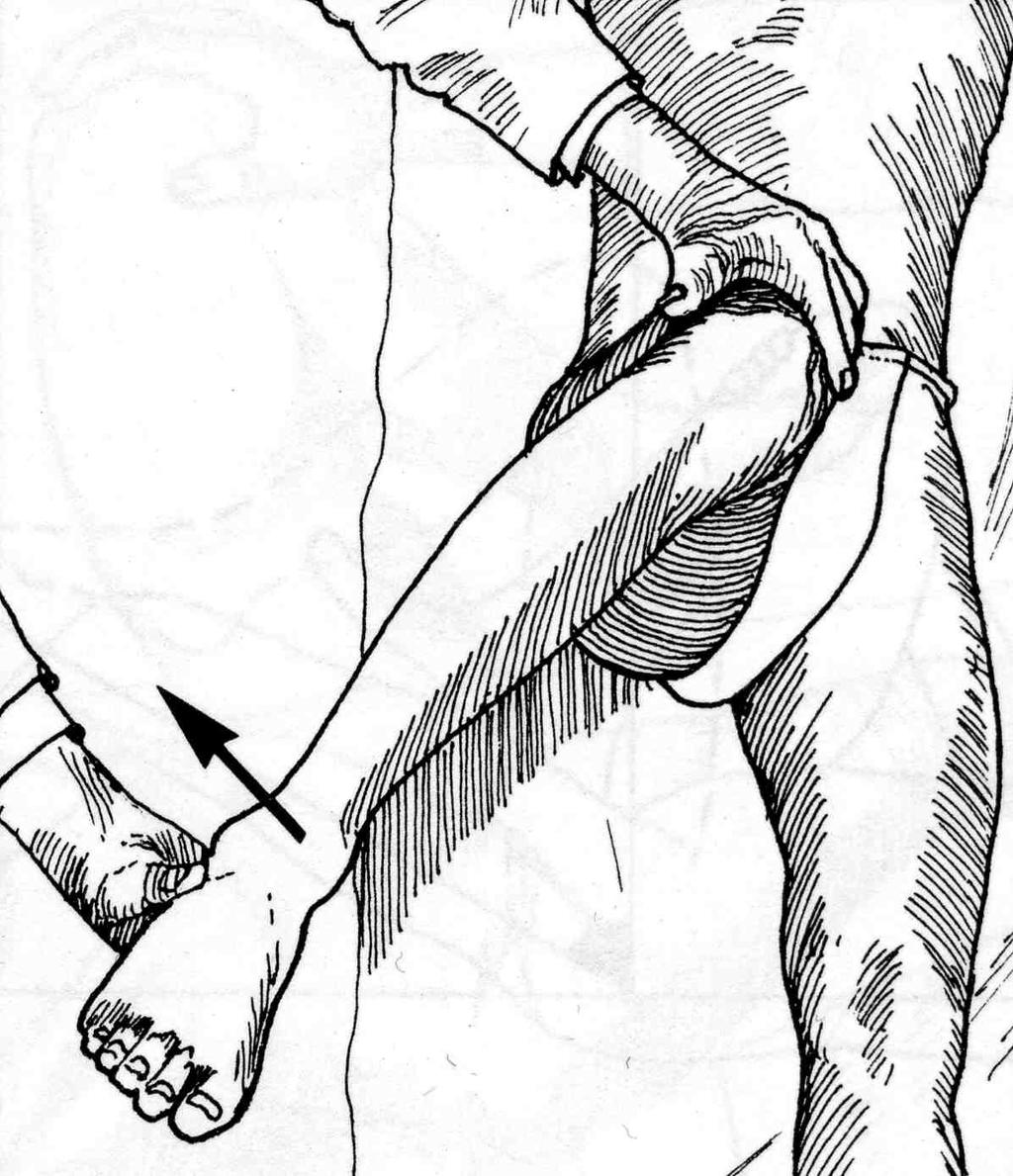 Trendelenburg - testar gluteal styrka (Crista iliaca