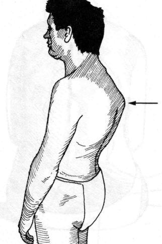 Palpation Spinalutskott tryck, perkussion Muskulatur sternocleido, nacke, utmed kotpelaren, lumbalt, glutealt ömhet? SI-leder 3.