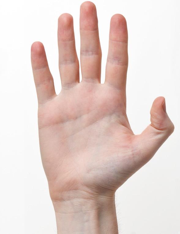 Hand /Torbjörn Vedung 160829 1. Inspektion Assymetri mellan sidorna; felställningar, atrofier? Svullnad, missfärgning? Arbetsvalkar, glansig eller torr hud? 2.
