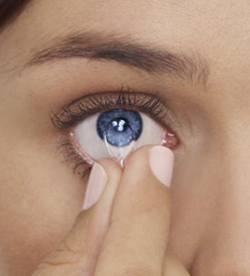 När du har hittat linsen kan du ta ur den med nypmetoden eller någon annan metod som din ögonspecialist rekommenderar. Nypmetoden 1. Titta upp och för linsen ner på ögonvitan med ditt pekfinger. 2.