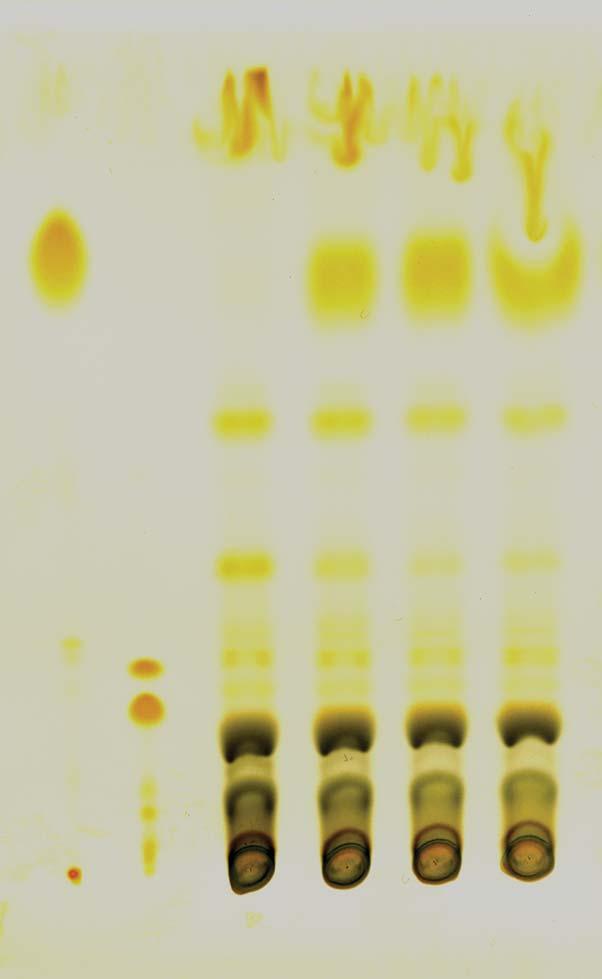 (A) A thin-layer chromatogram of lipid extracts is shown. Lipids were visualized by iodine staining. Soy oil was included as a standard.