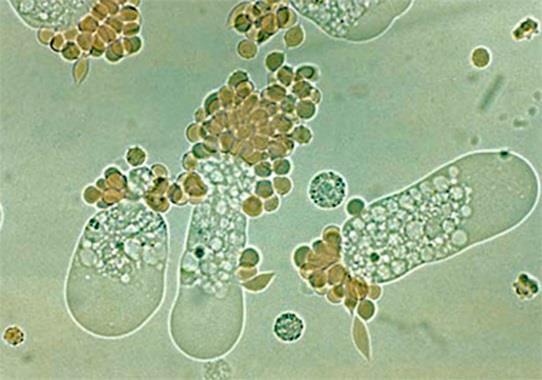 Parasiter och protozoer Särdrag klinik Antibiotika Giardia lamblia 1-2 v Subakut sekretorisk diarré, gaser, viktnedgång Ja Inkubationstid