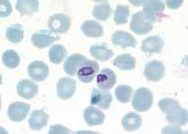 ga nuvarande profylaxregimer saknar effekt på kvarvarande malariaparasiter, hypnozoiter, i levern [14].