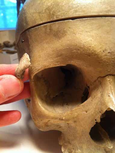 Osteologisk analys av bra