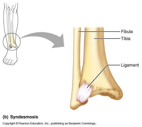 Fibrous joints Suture Bones tightly bound by