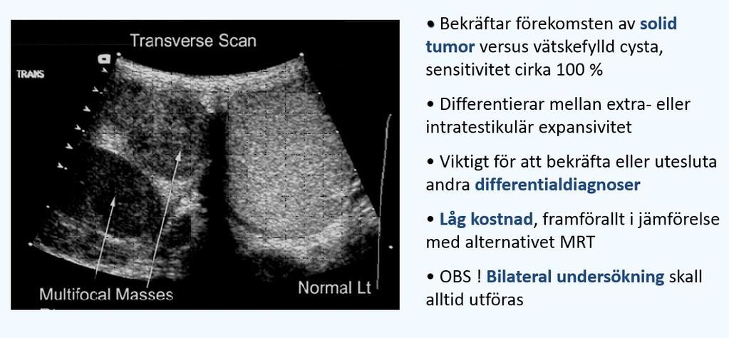 Sjukdomsutveckling, vårdkedja och vårdprocess Det vanligaste symtomet är palpabel resistens i skrotum, ibland förenat med tyngdkänsla, ömhet, värk, diffus obehagskänsla.
