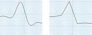 Area: Line: Points: Points+BestFitCurve: Points+BestFitLine: Points+Line: Points+Spline: Spline: Ytan under grafen fylls med den färg som valts under fliken Style.