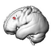 Ökade arbetsminneskrav ökad hjärnaktivitet Uppdatering av arbetsminnet: Basala ganglierna &