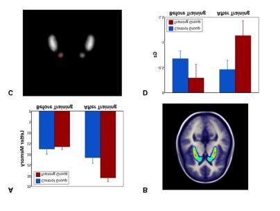 Reilly, 2006, Science McNab & Klingberg, NN, 2008) 5-veckors träning i att uppdatera