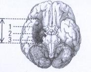 retrieval cues Hippocampus & episodic encoding Why is hippocampus crucial for encoding?