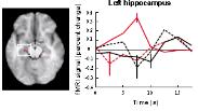 Revised consolidation model - encoding-retrieval interactions Memory retrieval: recognition She looks familiar Cortex 2 Stable, solid representations Re-activated representations - instable &