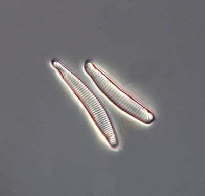 Figur 10. De surhetsindikerande arterna Eunotia incisa och Eunotia rhomboidea var vanliga i Gärsjöbäcken, Medins Biologi AB.