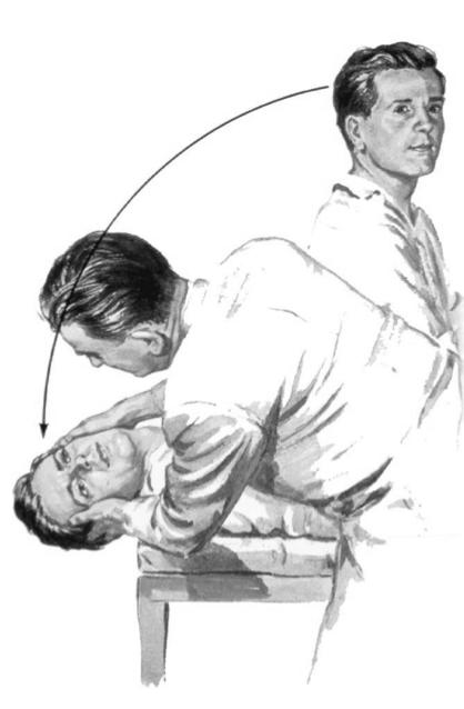 Det kan finnas en korrelation mellan demens och vestibular function!