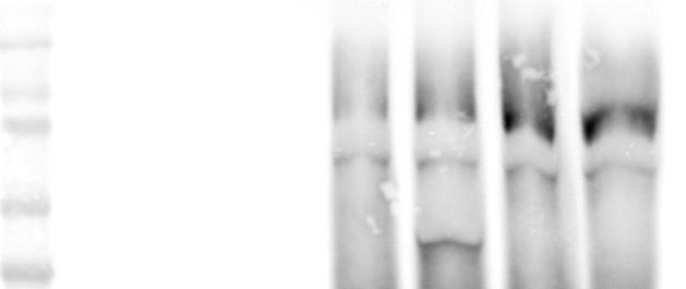 MBP MBP PUB1 MBP PUB1 UND GST LYK3 IR kda 130 72 55 40 Protein staining < GST Supplemental Figure 3.