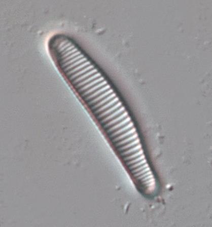 Figur 6. Eunotia incisa, Eunotia rhomboidea, Eunotia exigua var. tenella och Eunotia faba är exempel på surhetståliga arter,. 3.