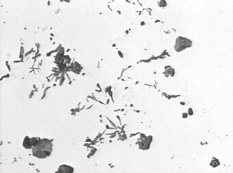 2 Intercellulär fjällgrafit Magnesium tillsätts vid segjärnsframställning för att erhålla en sfärisk grafitform.