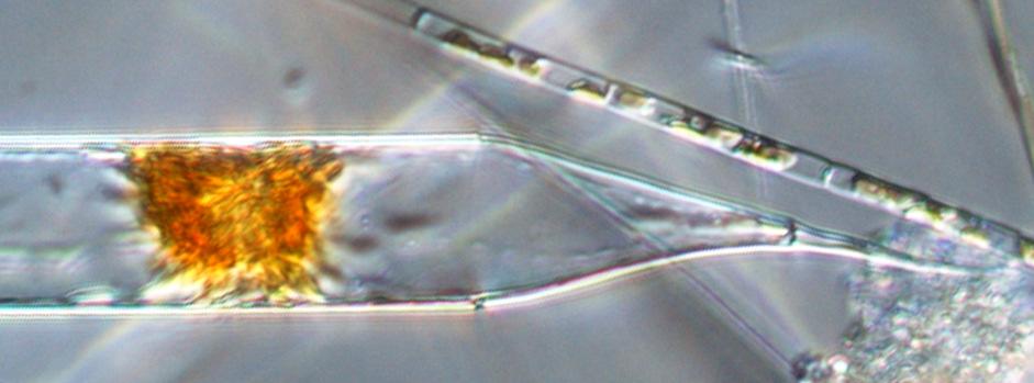 6000 5000 4000 3000 2000 1000 0 1 2 3 4 5 6 7 8 9 10 11 12 Foto: Lars Edler Azadinium spinosum* är en nybeskriven liten dinoflagellat som bildar det toxiska ämnet asparinsyra (AZA).
