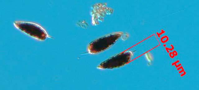 Prorcentrum redfeldii som är en liten dinoflagellat har påträffats de senaste åren med celltal upp till ca 10 000 celler/l.