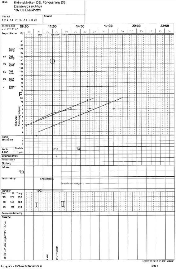 Oregelbundna menstruationer och datering av graviditet