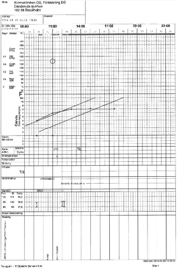 a. Vad kallar man tillståndet och hur kan man lämpligen handlägga denna patient? Sekundär värksvaghet. Amniotomi, oxytocinstimulering. b. Vad kan det bero på?