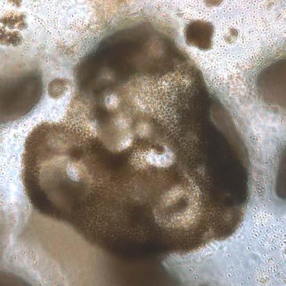dricksvattenproducenter Dolichospermum flos-aquae