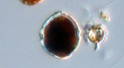 Bland dinoflagellater hör släktet Alexandrium* till de mest toxiska och gränsvärdet är så lågt som 200 celler per liter.
