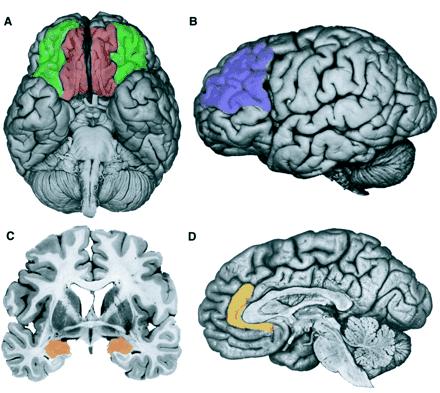 UTVECKLING AV EF Utvecklingen av exekutiva funktioner sammankopplas med mognad av frontalloben samt dess koppling till andra områden i hjärnan.