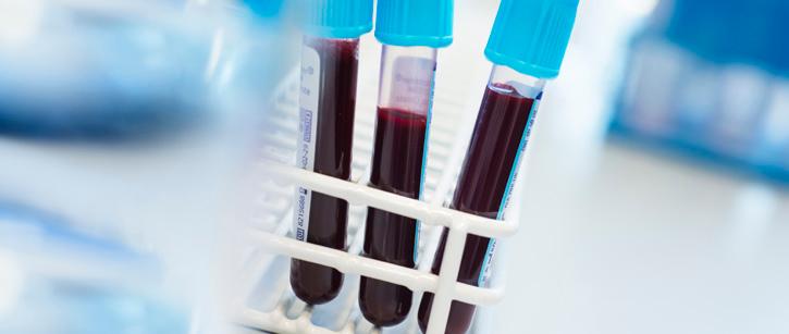 som lett till sepsis. Detta behöver göras innan några mediciner så som antibiotika eller annan behandling sätts in.