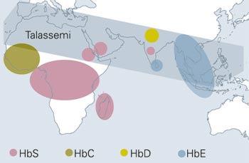 Global distribution av Hb-varianter Hemoglobinvarianter The Big Four Hb-variant Genotyp Fenotyp HbE Beta globin cd 26 GAG AAG Beta-thalassemisk Heterozygot har ca 30 % Hb E HbS Beta globin cd 6 GAG