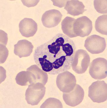 Basofiler Basofilen är den mest ovanliga leukocyten vid differentialräkning.