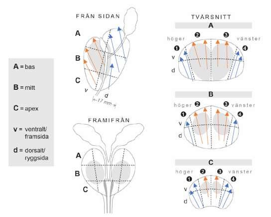 8.6.3 Systematiska transrektala biopsier Nedanstående rekommendationer gäller huvudsakligen för handläggning av män med misstänkt prostatacancer som kan bli föremål för kurativt syftande behandling.